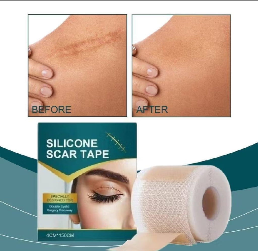 Reduza Cicatrizes, Estrias e Marcas de Acne com Facilidade