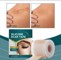 Reduza Cicatrizes, Estrias e Marcas de Acne com Facilidade