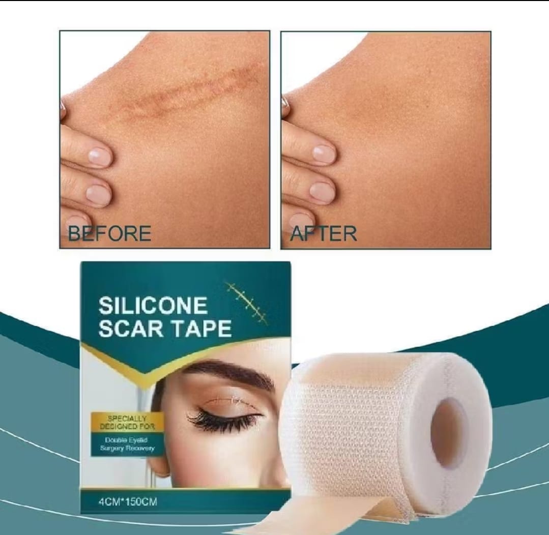 Reduza Cicatrizes, Estrias e Marcas de Acne com Facilidade